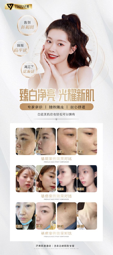 瘦身减肥合作已秀品牌